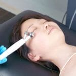 How RF Treatment Revives Droopy Eyelids