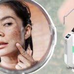 Banish Dark Spots for Good with the Pico Laser Advantage