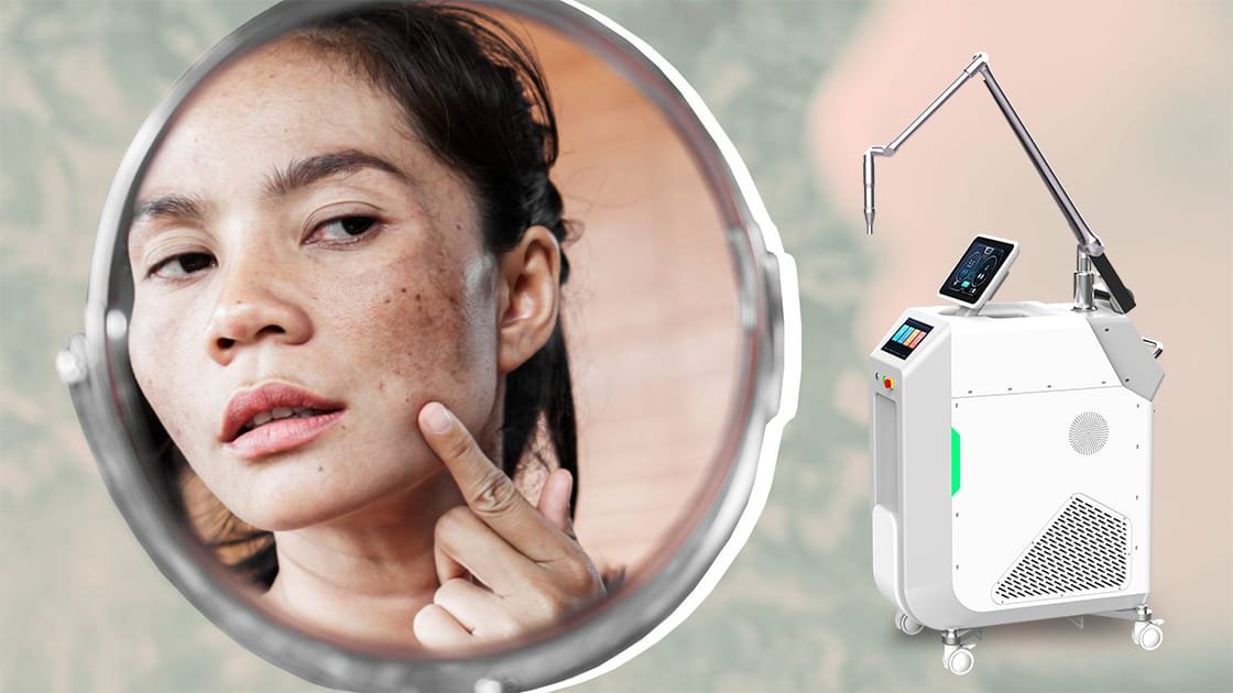 Banish Dark Spots for Good with the Pico Laser Advantage