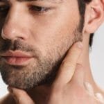 Bid Farewell to Sideburns: Laser Hair Removal Magic