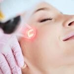 Glow Up: Can Pico Laser Really Brighten Your Skin?