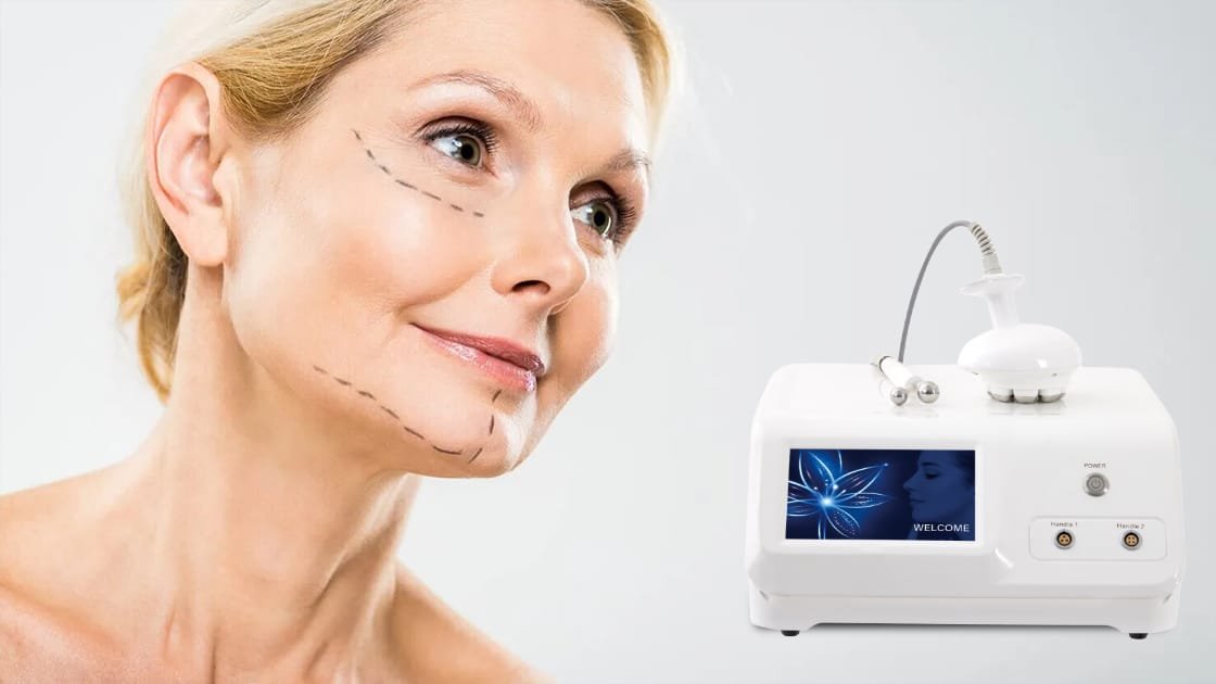 Tighten Up! How Radiofrequency Firms Loose Skin