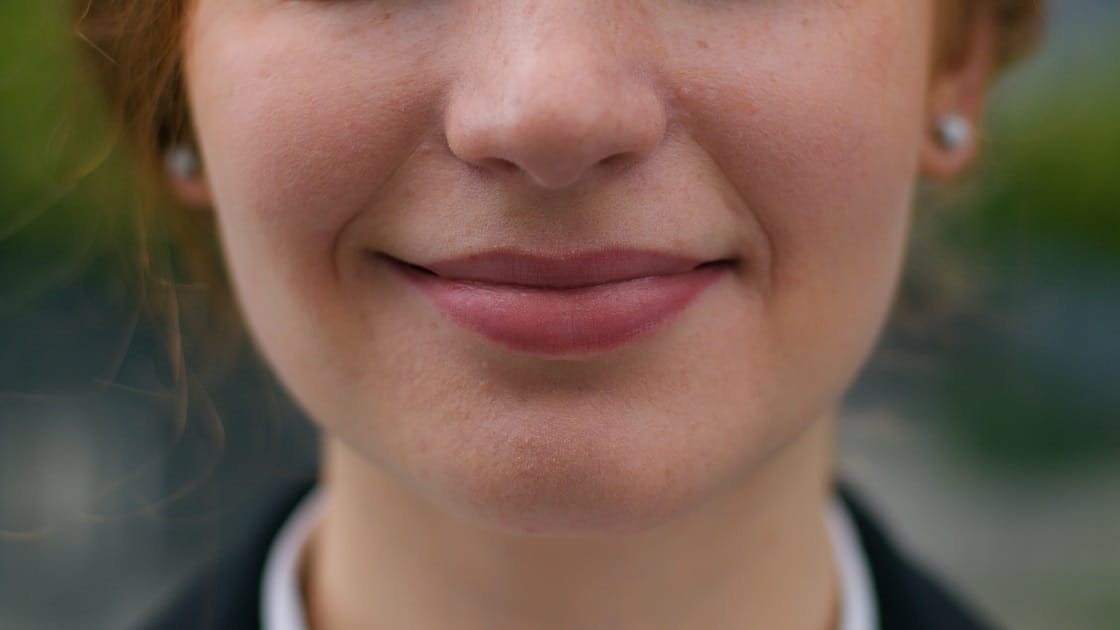 The Lip Lines Vanish: A Radiofrequency Makeover