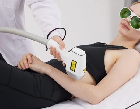 Laser hair removal for arms