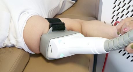 Laser lipolysis for shoulder definition