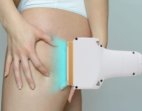 Laser lipolysis for thigh