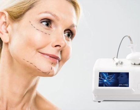 Radiofrequency skin tightening