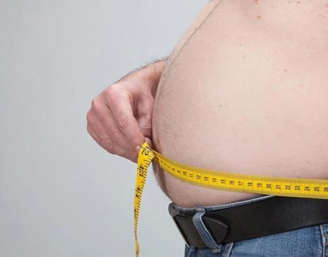 laser lipo for obesity